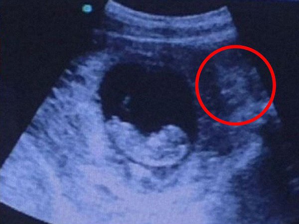 டிமோன் :