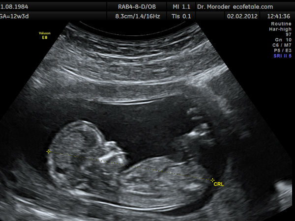 விளக்கம் :