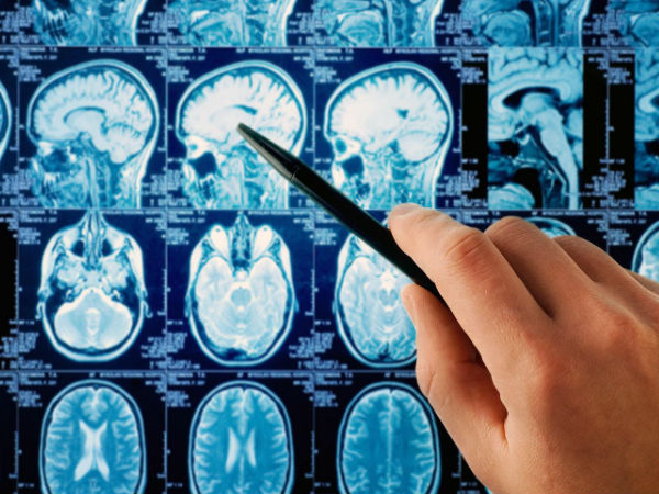 புற்றுநோய் :