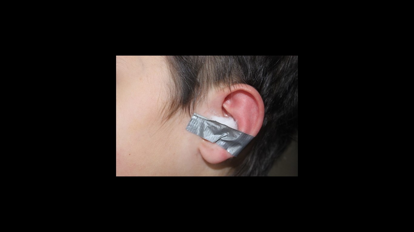 பக்க விளைவு #2