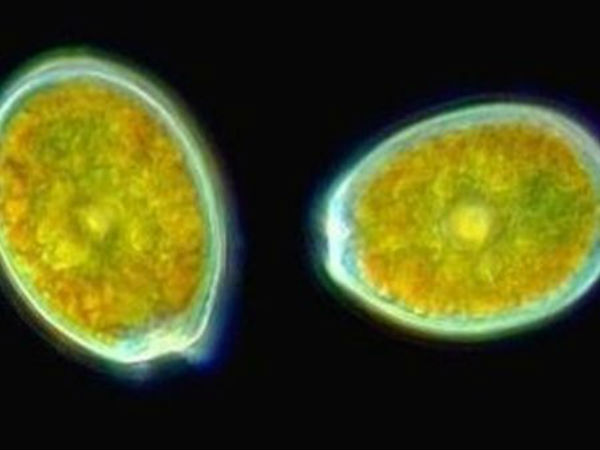 முன்னேற்றம் :