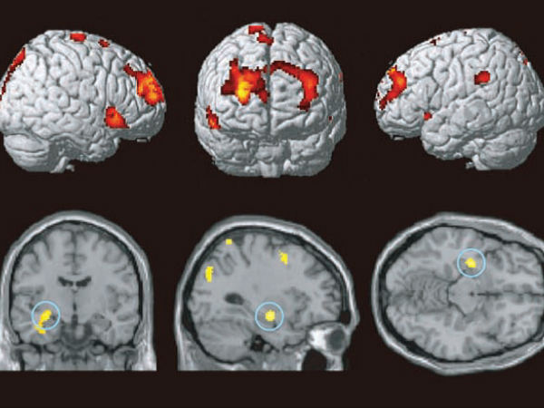 உங்களுக்கே தெரியாமல் உங்களுள் இருக்கும் நோய் - டிஜிட்டல் அம்னீசியா..!