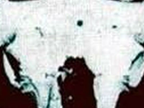 #3