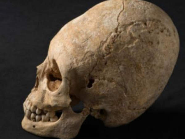 மண்டை ஓடு