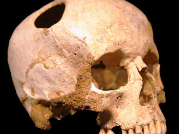 அறுவை சிகிச்சை