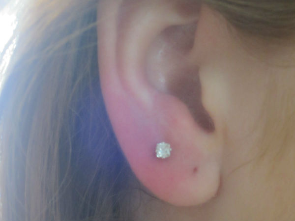 பக்க விளைவு #4