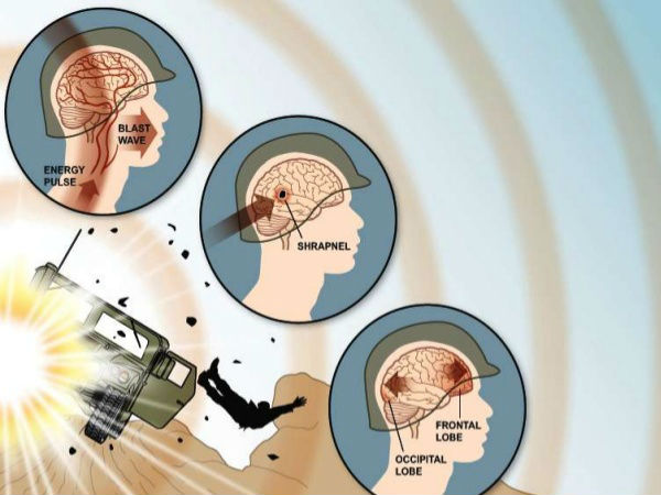 உள்ளே திணிக்கப்பட்ட வெடிப்பு பொருளானது