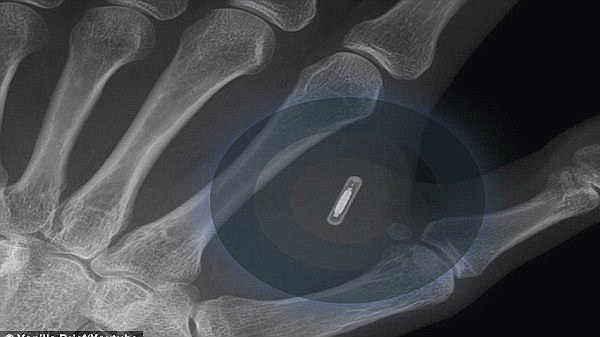 நீக்கமுடியும். 