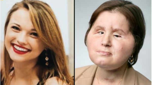 100%  கேட்டி ஸ்டப்பில்பீல்ட் 