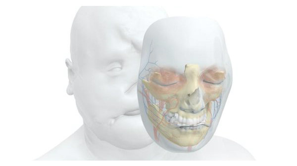 31 மணி நேர முக மாற்று அறுவை சிகிச்சை