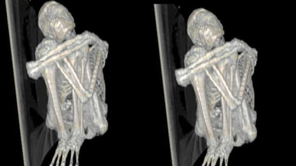 5ம் நூற்றாண்டை சேர்ந்தது: 