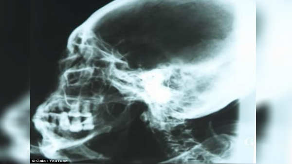 டிஎன் ஏ பரிசோதனை:   