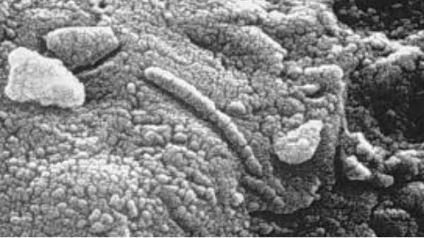 பராடோலியா நோய் 