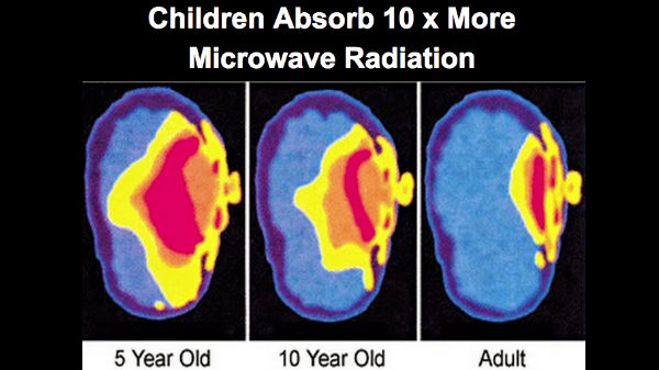 3 வயதுக் குழந்தைகளுக்கு அதிக பாதிப்பு 