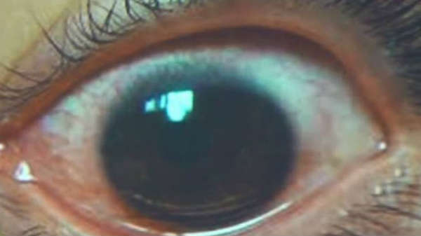 மிகவும் மோசமான நிலைமை!