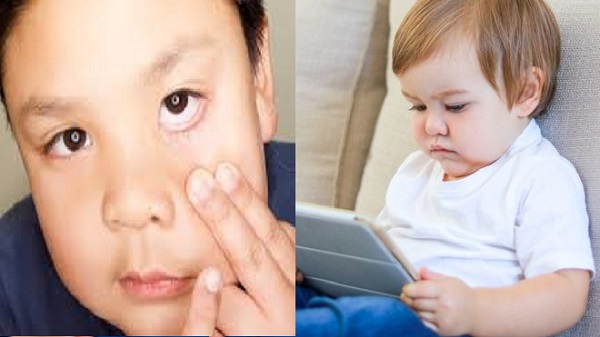  கருவிழியில் அதிகப்படியான சேதாரம் 