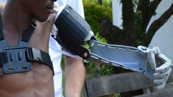 10 கிலோ எடையை தூக்கும் பிளாஸ்டிக் செயற்கை கை