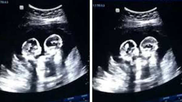 இணையதளத்தில் வெளியீடு :