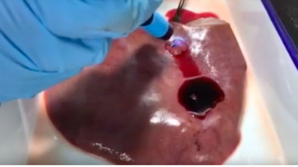  ஈரமான இடங்கள் மற்றும் உயர் இரத்த அழுத்த இடங்களில் க்ளூ