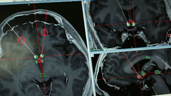 பேட்டரி 