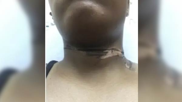 சிகிச்சைக்கு வந்த பெண்:  