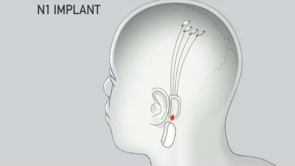 அறுவைசிகிச்சை போல இல்லை