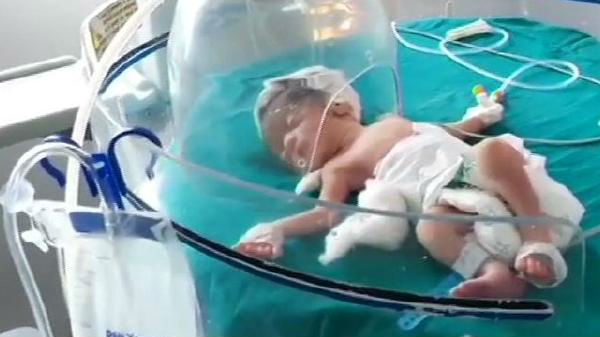 குழந்தை மருத்துவமணியில் அனுமதி