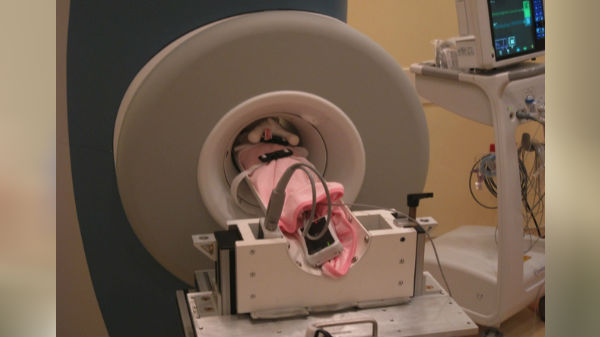  சிறிய எம்ஆர்ஐ இயந்திரம் 