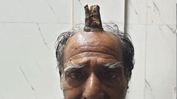 இது என்ன வகை நோய் என்று தெரியுமா?