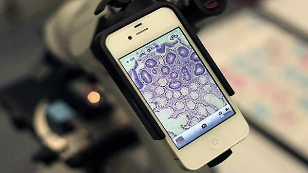 ஸ்மார்ட்போன் கேமராவை மைக்ரோஸ்க்கோப்பாக மாற்றலாம்