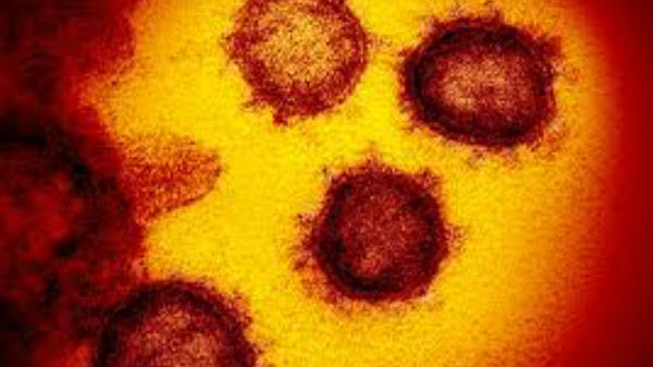  சார்ஸ், கோவ்-2 