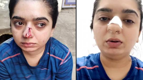 வழியும் ரத்தத்துடன் வீடியோ