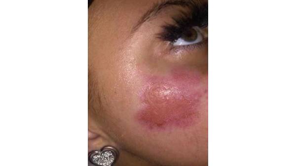 தீவிபத்துக்கான காரணம் என்ன