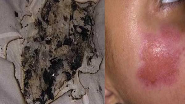 சிறிய காயங்களுடன் தப்பித்தார்