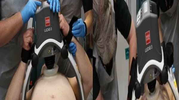 சிபிஆர் சிகிச்சை