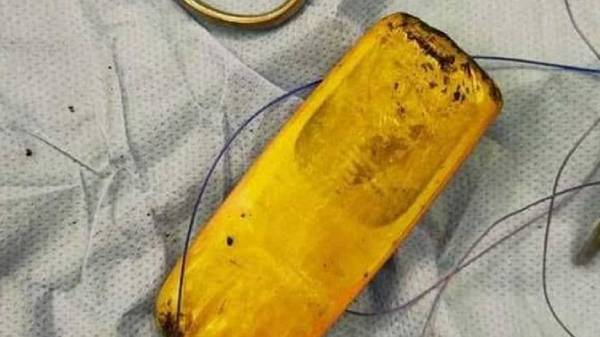  இந்த விஷயத்தை