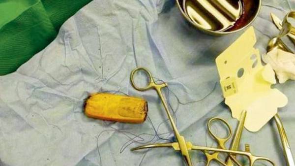 பாதிக்கப்பட்ட நோயாளியின்