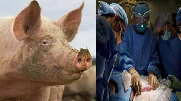 உறுப்புகளில் கோளாறு ஏற்பட்டு உயிரிழக்கும் மனிதர்களை காப்பாற்றும் முயற்சியா இது?