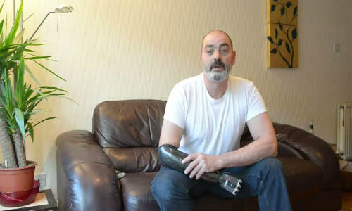 terminator-arm-bebionic3-rslsteeper-11