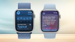 Apple Vitals App ఆరోగ్య సమస్యలు వస్తాయని ముందుగానే చెప్పేసే ఆపిల్‌ వాచ్‌ ఫీచర్‌.. ఎలా పనిచేస్తుంది..?