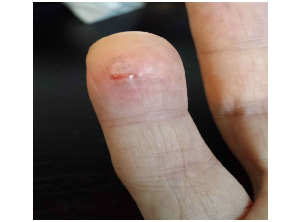 పేలిన సామ్‌సంగ్ ఫోన్..మహిళకు గాయాలు!