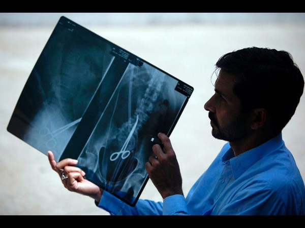 worst x rays in the world