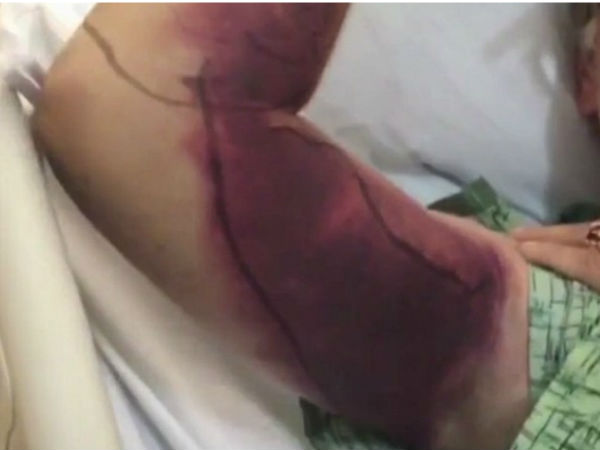 పాముతో సెల్ఫీ... చచ్చి బతికాడు