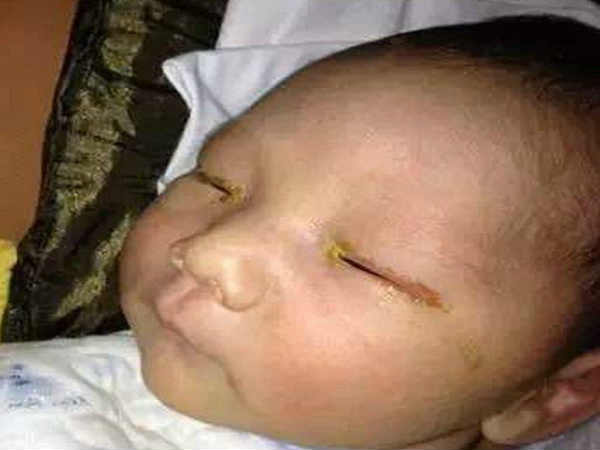 ఫోటో తీయడమా అమ్మో...