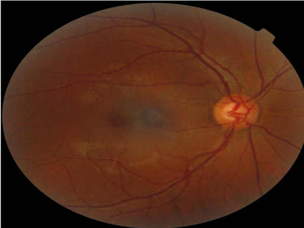 ఫోటో తీయడమా అమ్మో...