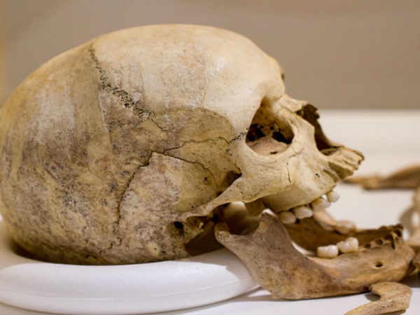 3డీ స్కానింగ్‌తో పుర్రెకు వాస్తవ రూపం