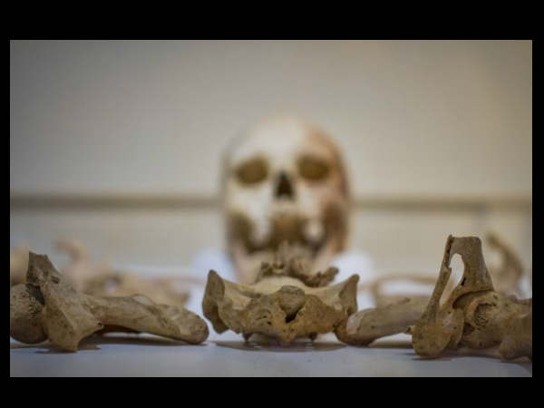 3డీ స్కానింగ్‌తో పుర్రెకు వాస్తవ రూపం