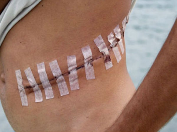  కొత్త ఐఫోన్ కోసం కిడ్నీ బేరం!