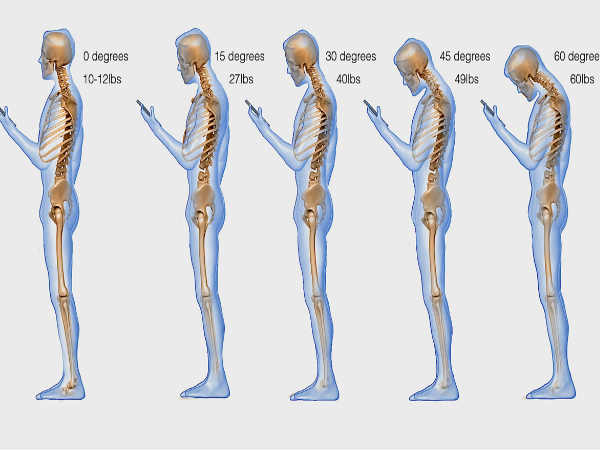 తలను వంచి గంటల పాటు సెల్‌ఫోన్‌ మాట్లాడే వారికి సమస్యలు 