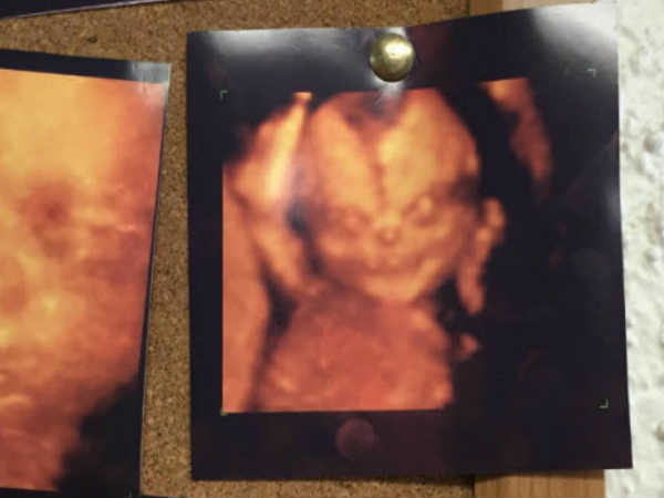 ఇంటర్నెట్‌లో హల్‌చల్ చేస్తున్న పలు భయనాక ఎక్స్-రేలతో పాటు అల్ట్రా సౌండ్ దృశ్యాలు